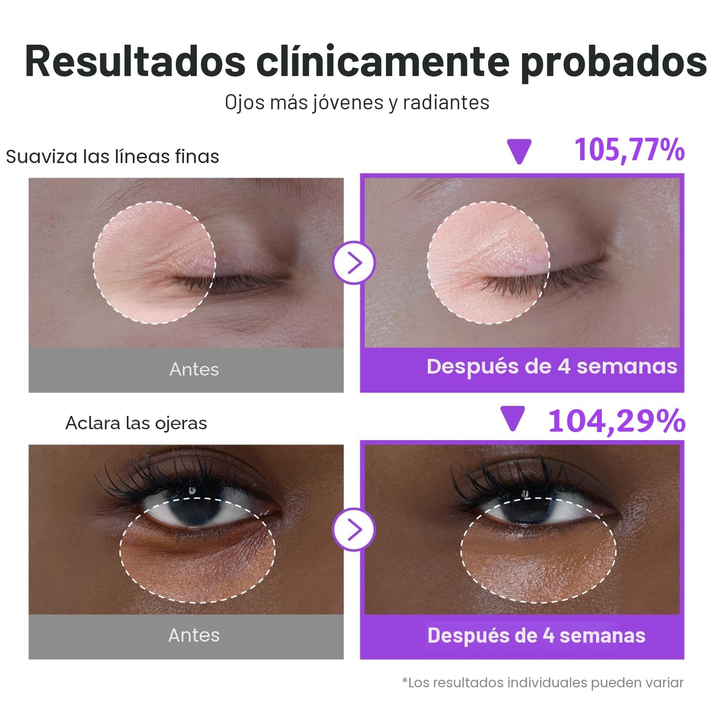 Crema de Ojos con NAD+ y Retinol para Ojeras, Arrugas y Mirada Cansada